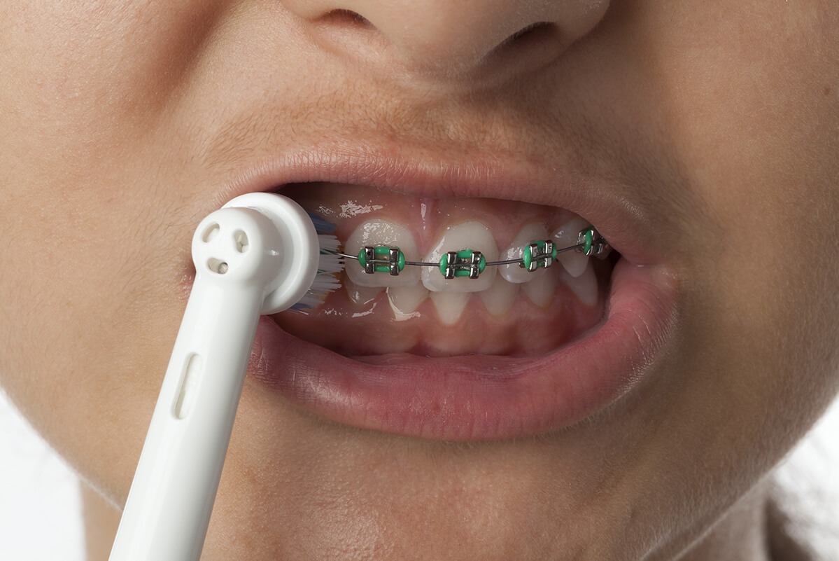 Toothbrush For Braces
